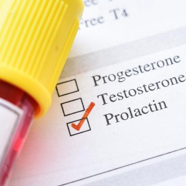 High prolactin levels: a common cause of infertility
