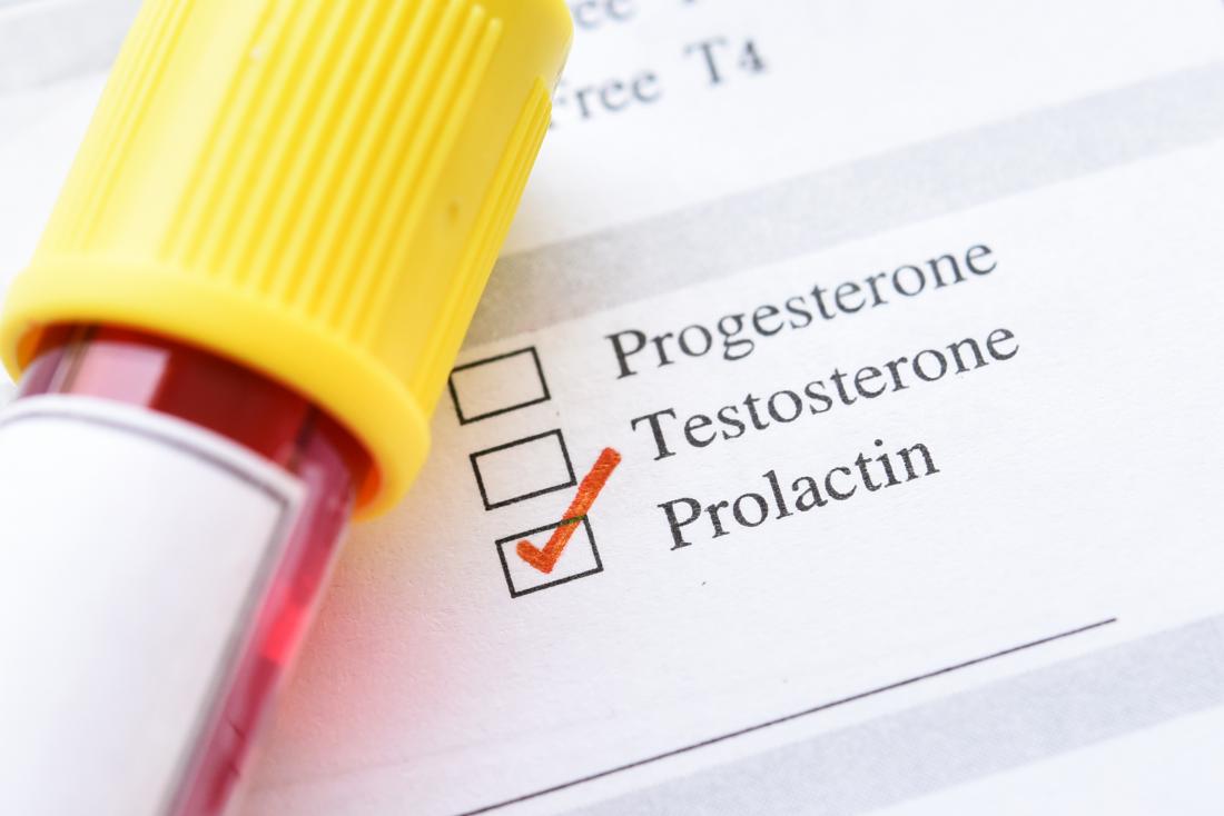 High prolactin levels: a common cause of infertility